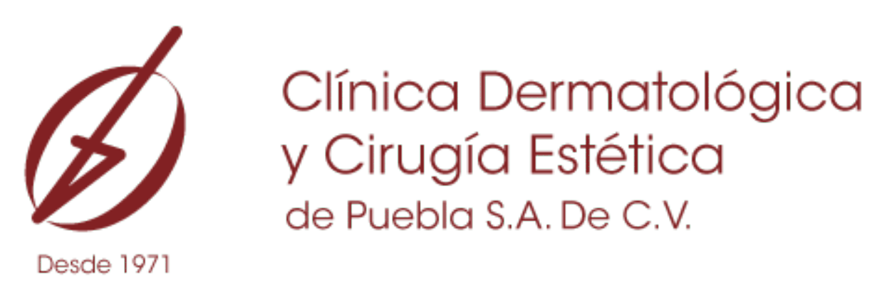 Láser Puebla