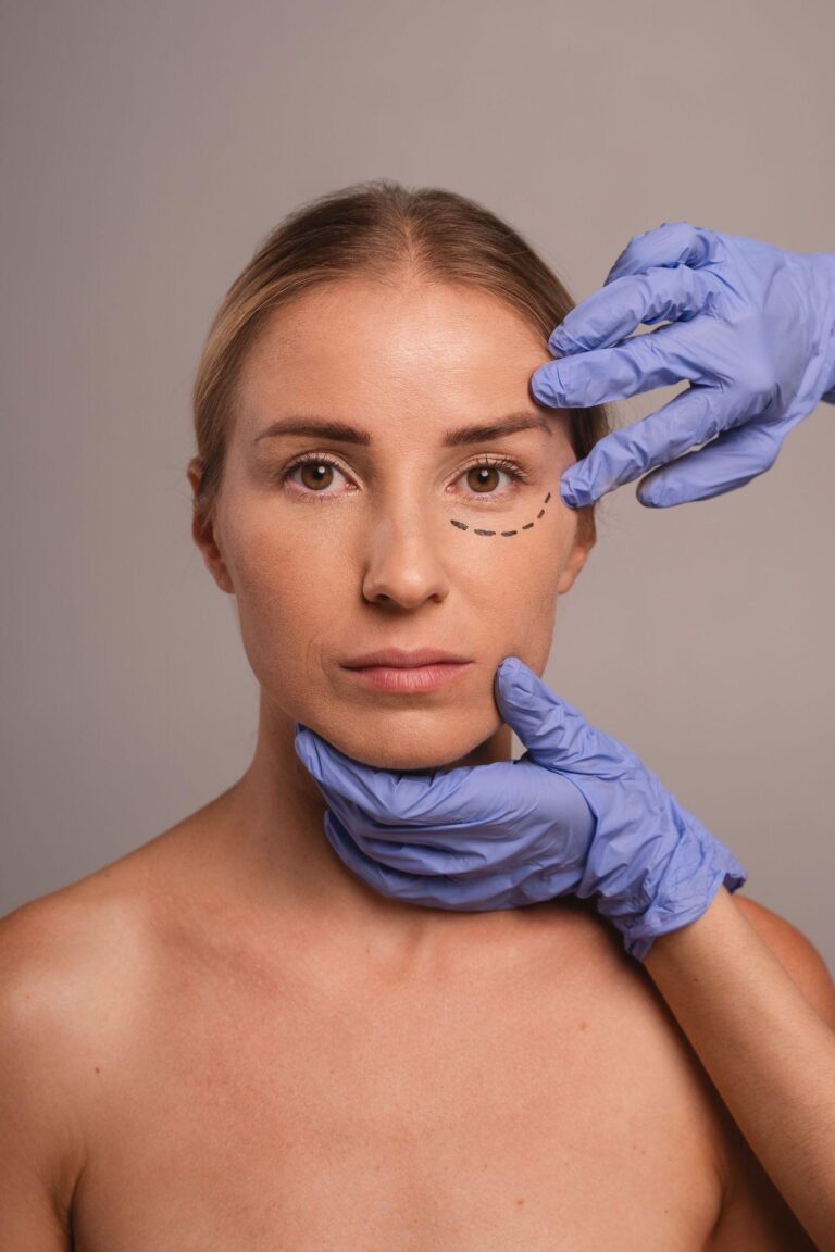Blefaroplastia Puebla , corrige el exceso de piel, bolsas y ojeras en los párpados hoy.